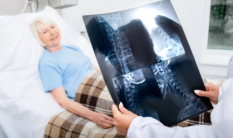 osteokondrosiaren diagnostikoa