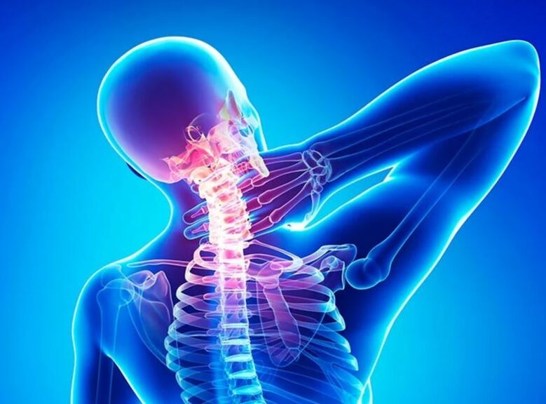 Bizkarrezurreko bizkarrezurraren osteokondrosia