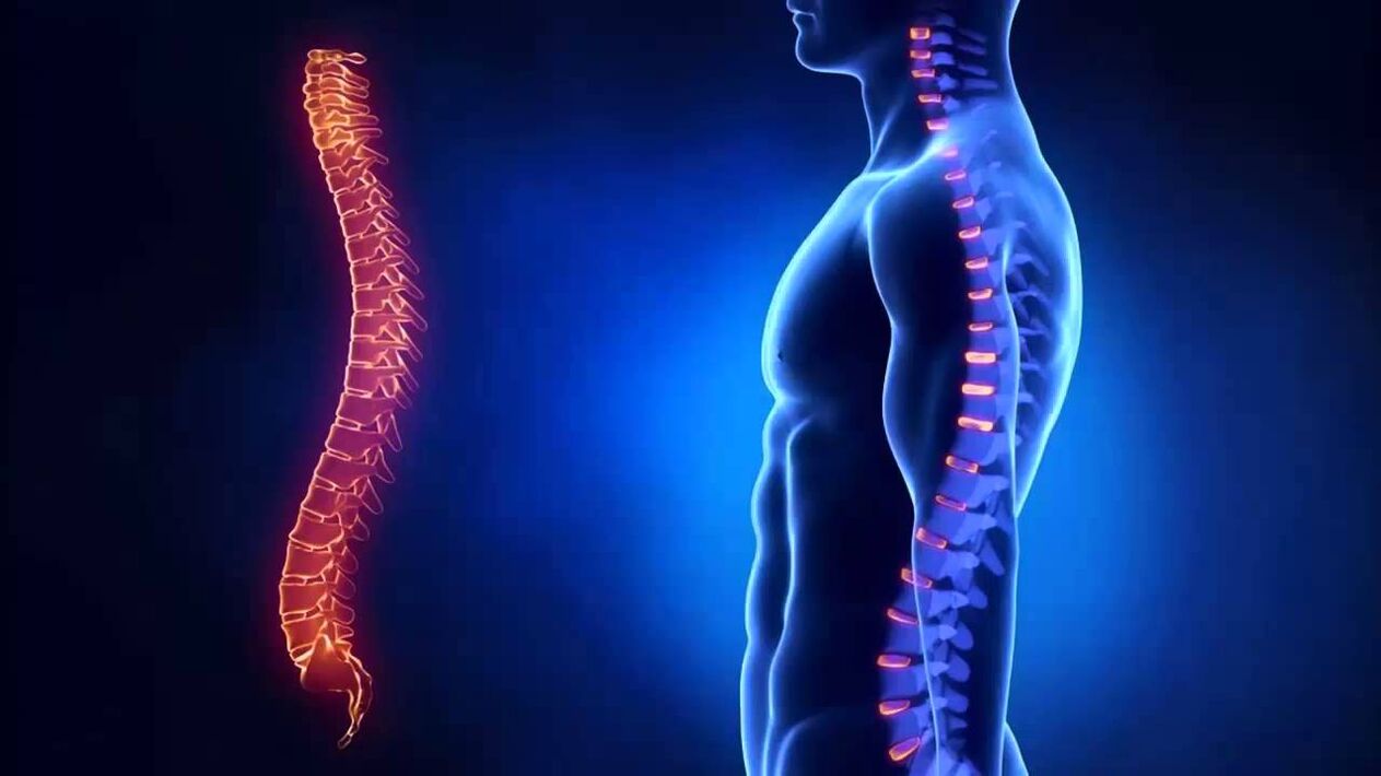 Osteokondrosia